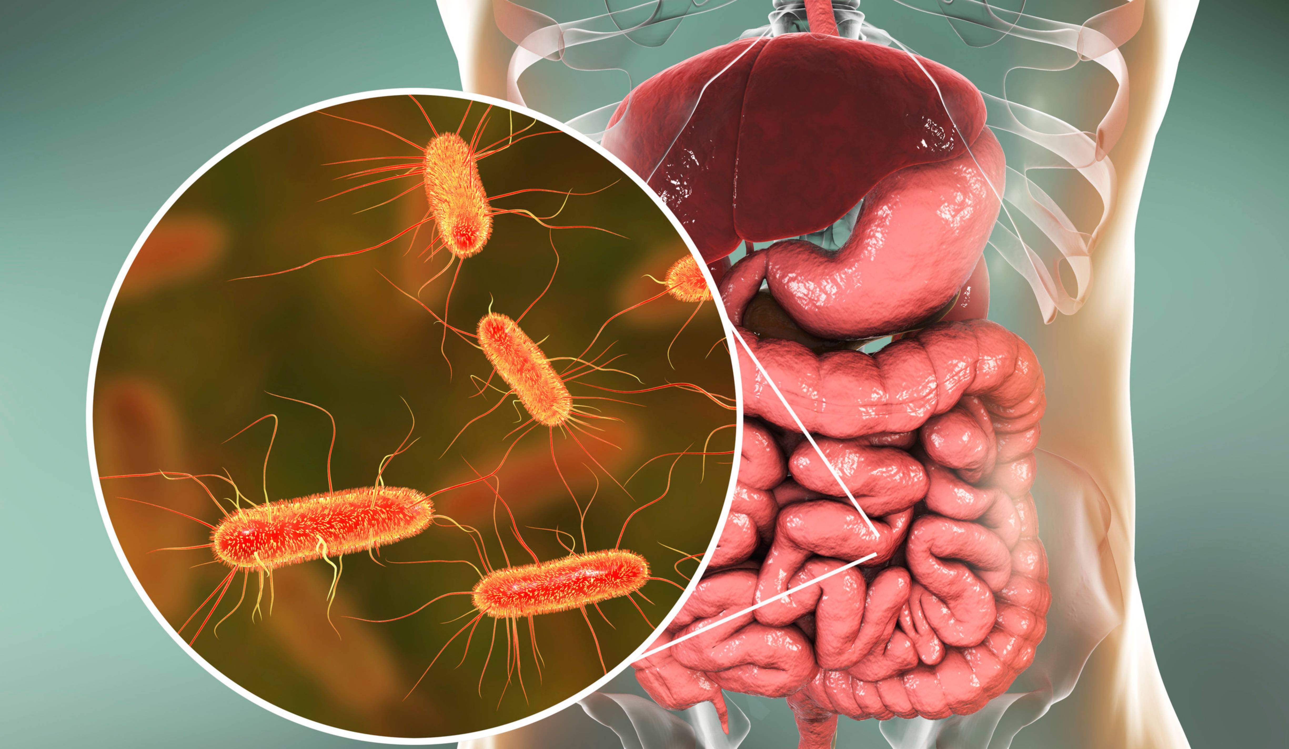 Dünndarmfehlbesiedlung (SIBO): Symptome, Ursachen & Diagnose